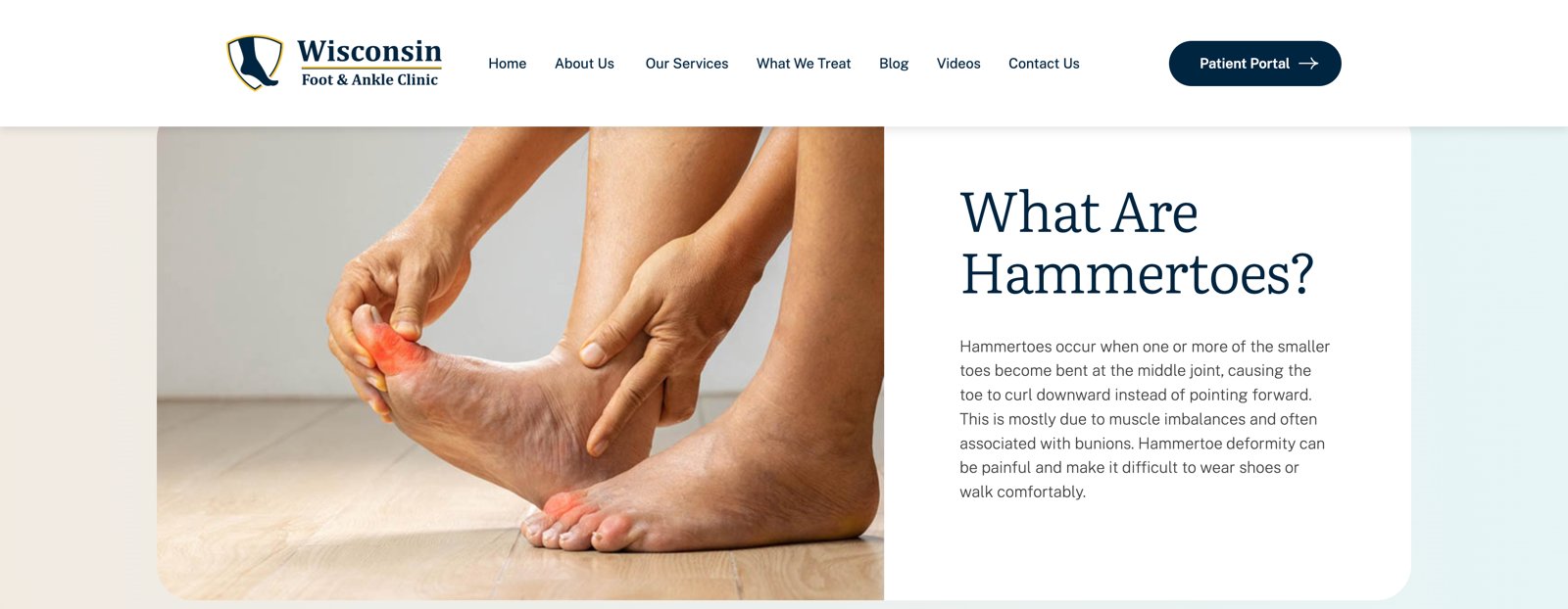 What Are Hammertoes condition detail page with plain-language explanation and treatment photo
